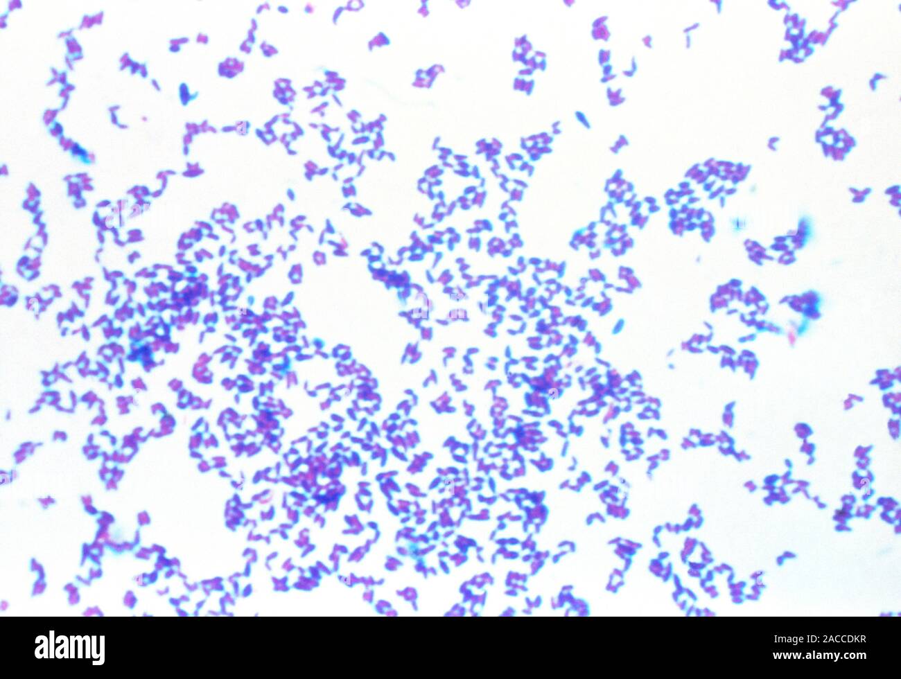 Light micrograph of Corynebacterium diphtheria, a medium sized rod ...