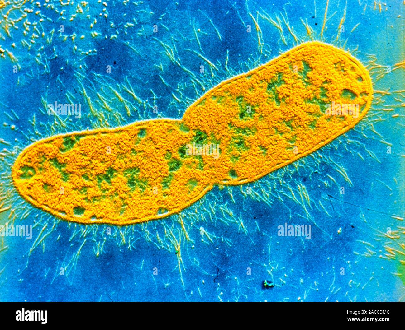 False colour transmission electron micrograph (shadow technique) of ...