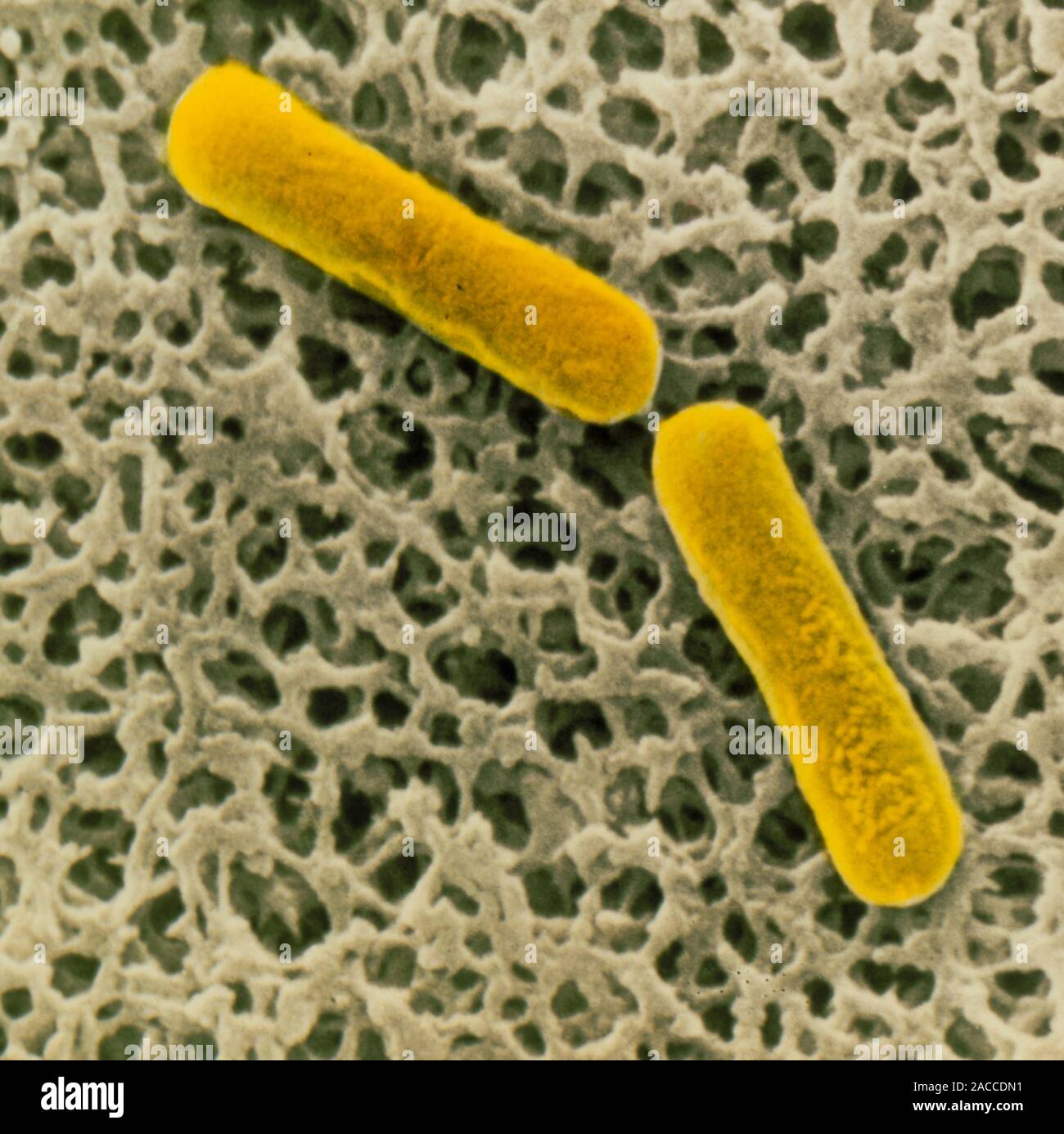 Scanning Electron Micrograph of two individual rodlike, Grampositive