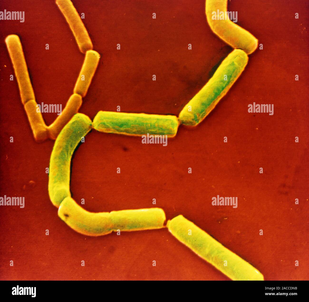 False-colour scanning electron micrograph (SEM) of chains of the Gram ...