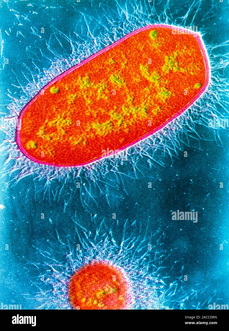 False colour transmission electron micrograph (TEM) of two gram ...