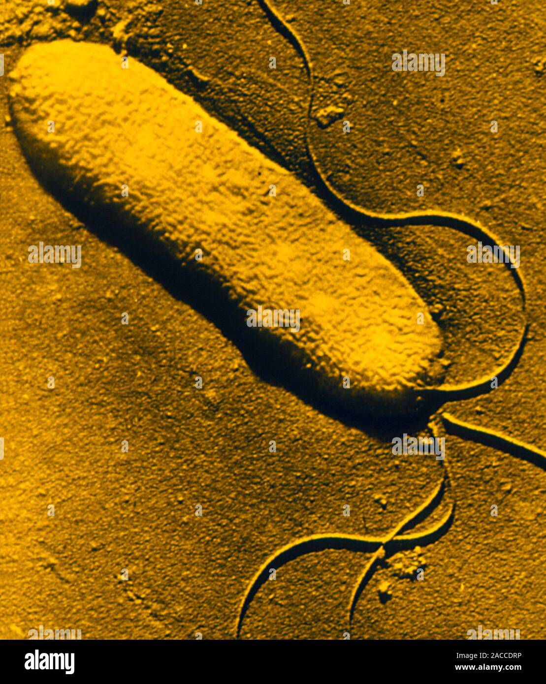 False colour transmission electron micrograph (shadow method) of the ...