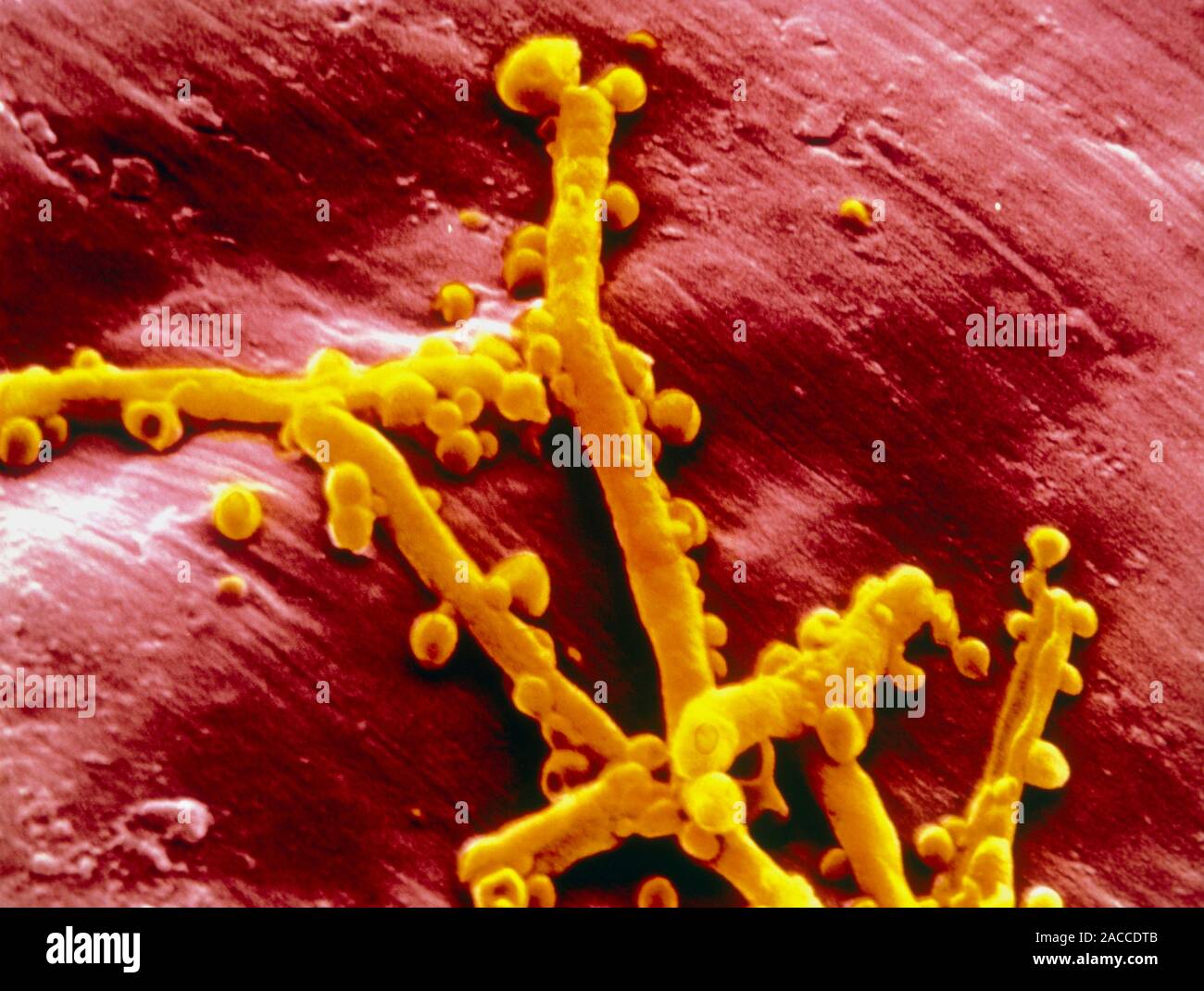 False colour scanning electron micrograph (SEM) of a colony of ...