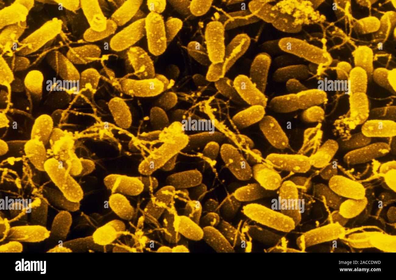 False colour scanning electron micrograph (SEM) of a colony of ...