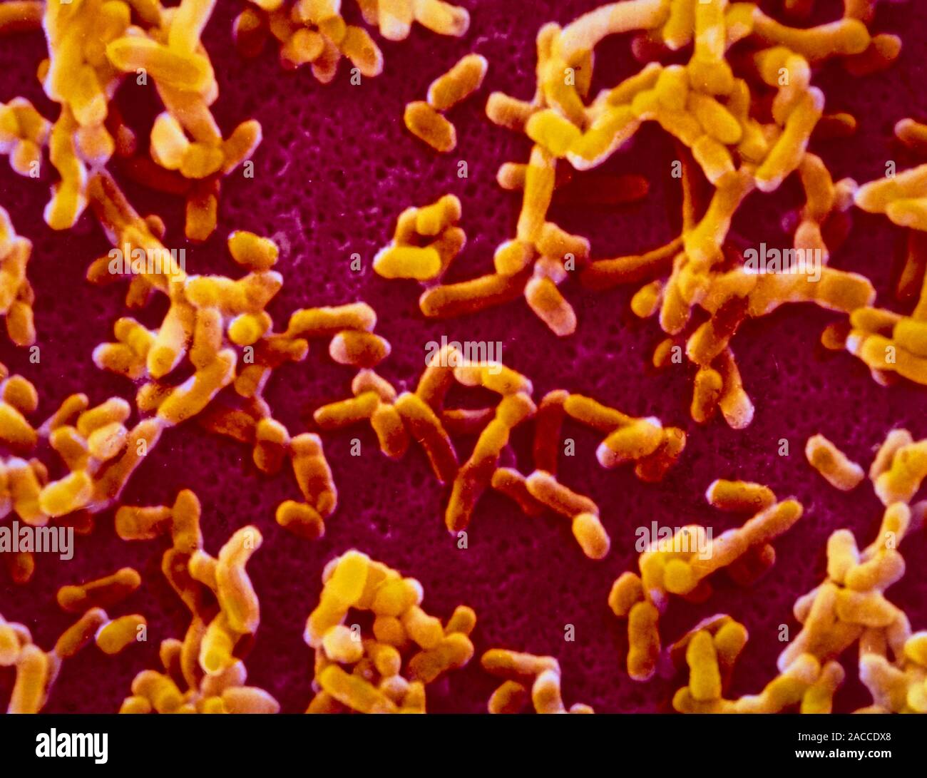 False-colour scanning electron micrograph (SEM) of Yersinia pestis, a ...