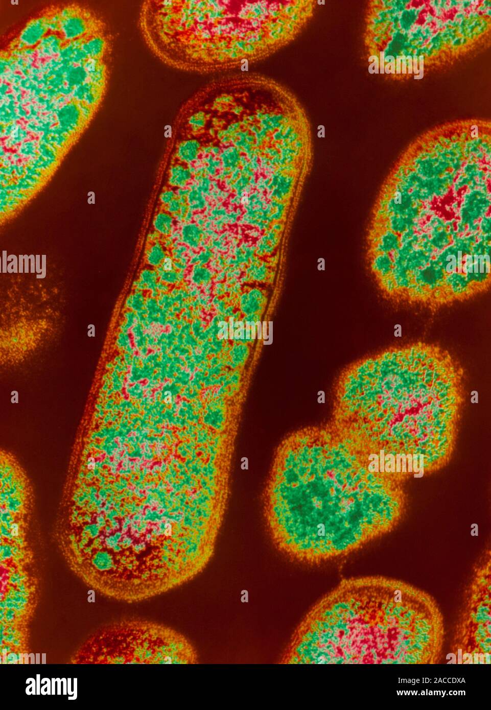 False-colour transmission electron micrograph of Gardnerella vaginalis ...