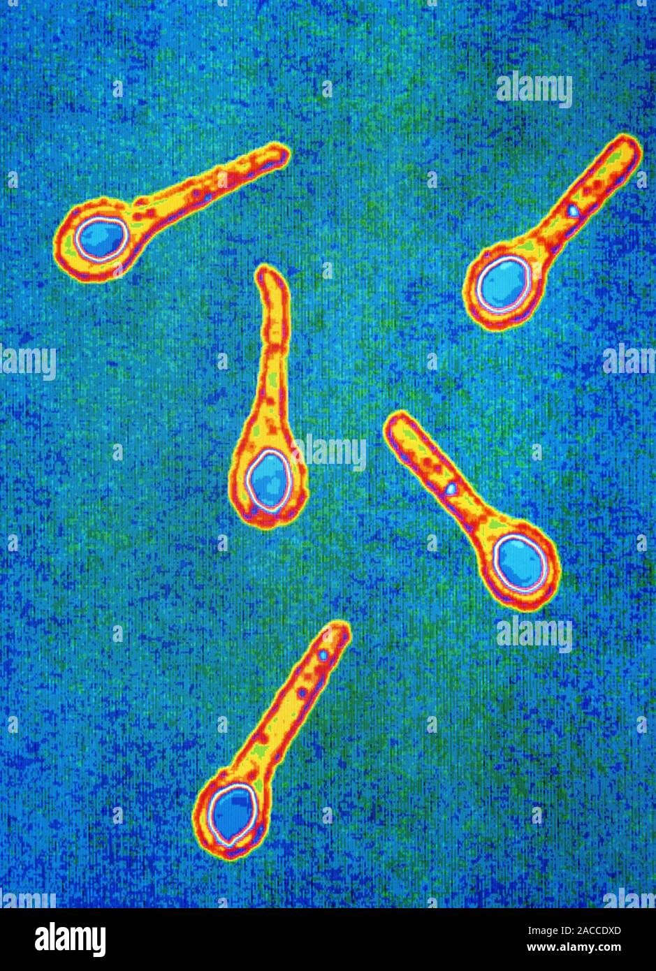 False-colour transmission electron micrograph (TEM) of the bacterium ...