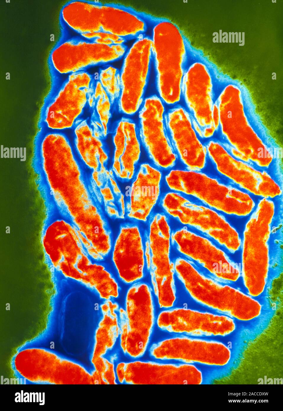 False-colour transmission electron micrograph of a group of Coxiella ...