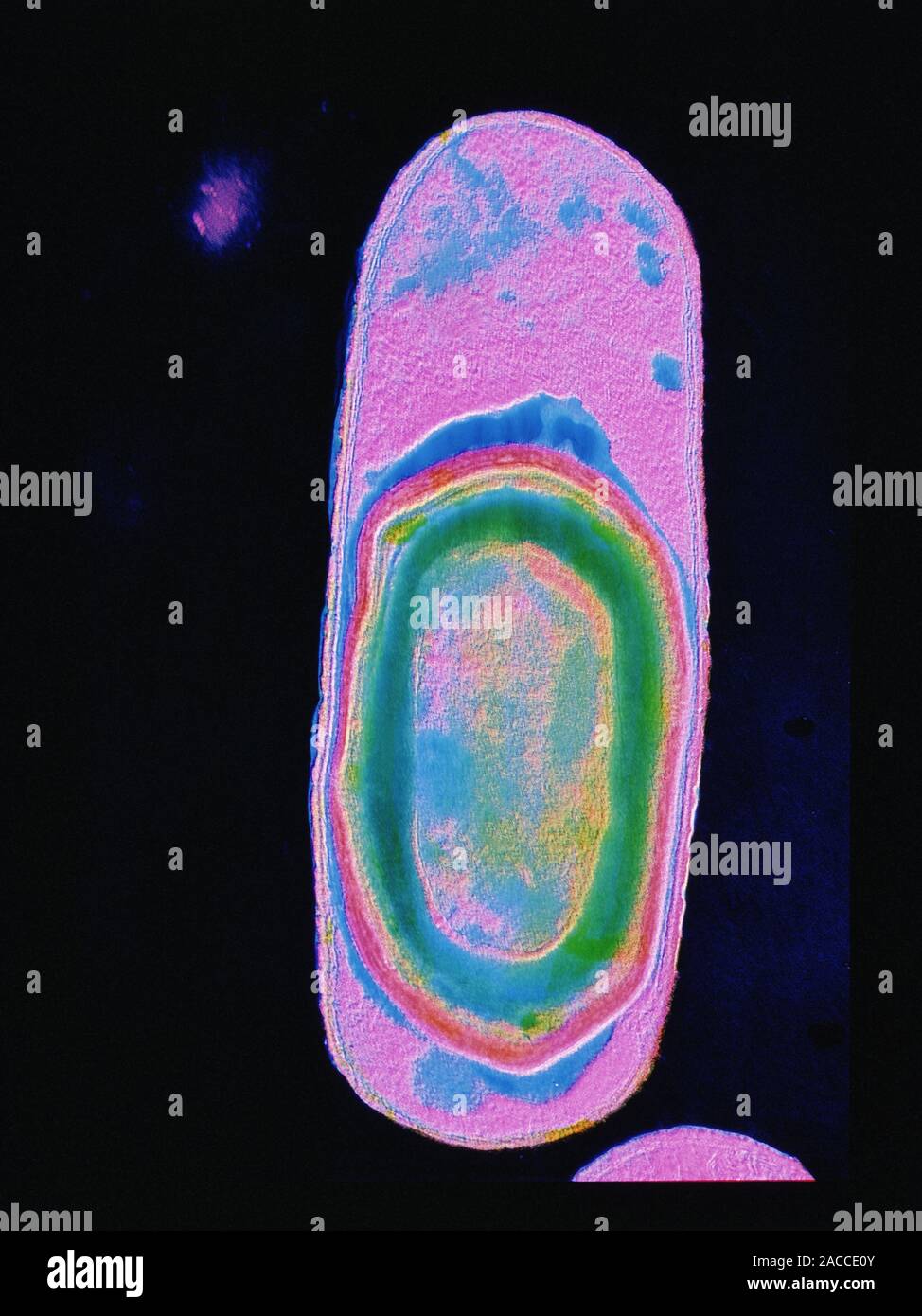 Falsecolour transmission electron micrograph (TEM) of a single
