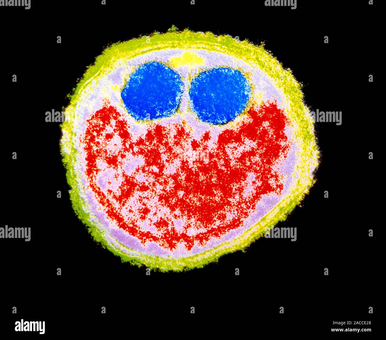 Coloured transmission electron micrograph (TEM) of a transverse section ...