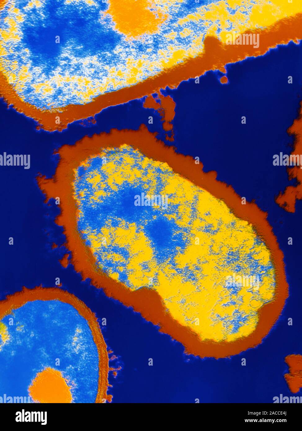 Listeria monocytogenes. Coloured transmission electron micrograph of