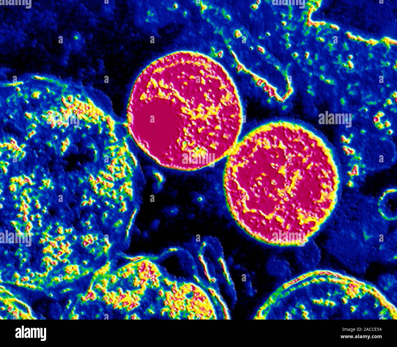 Хламидии 4. Бактерия хламидия трахоматис. Хламидия трахоматис микроскопия. Хламидия трахоматис под микроскопом.