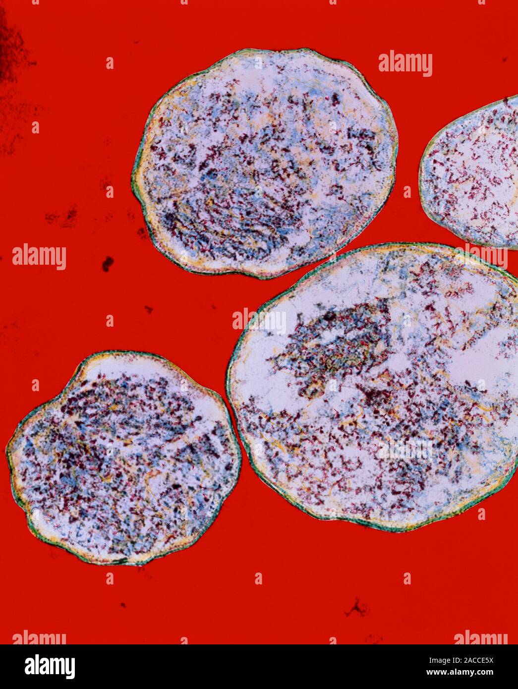 Chlamydia trachomatis. Coloured transmission electron micrograph of