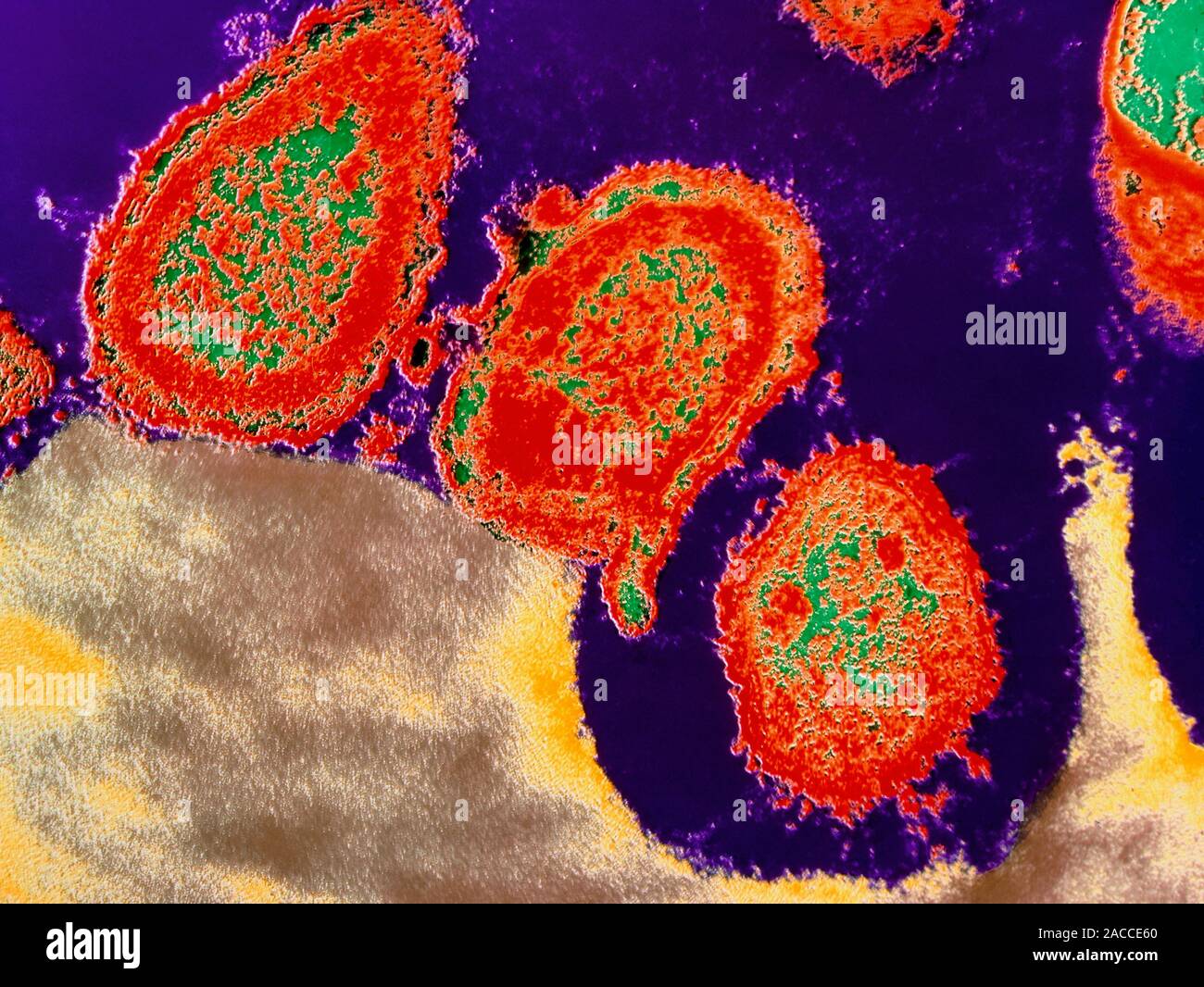 Rumen bacteria. Coloured Transmission Electron Micrograph (TEM) of ...