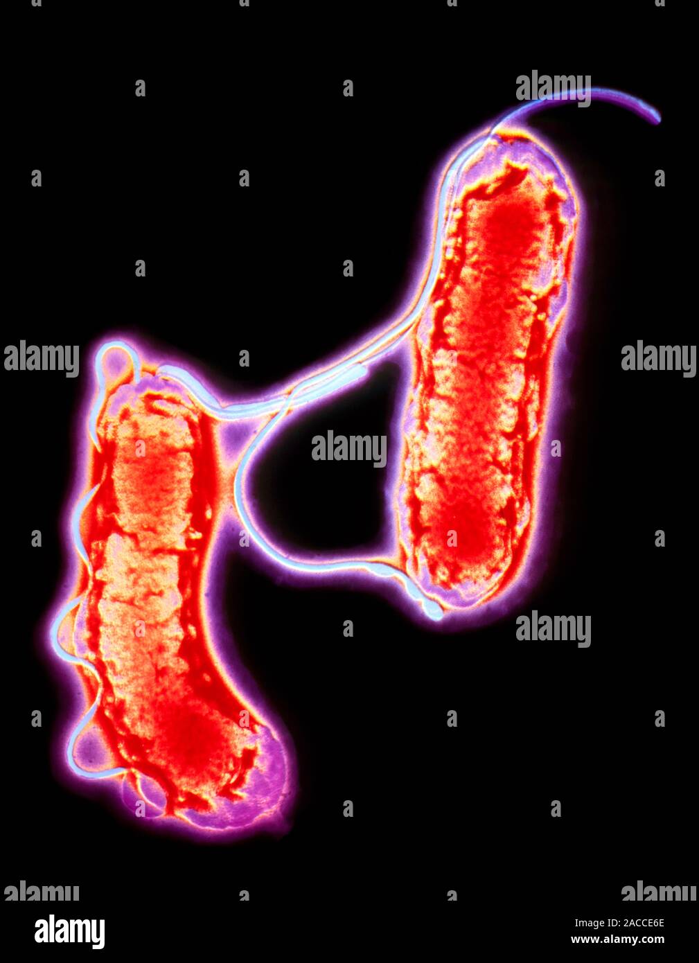 Helicobacter pylori. Coloured transmission electron micrograph of two