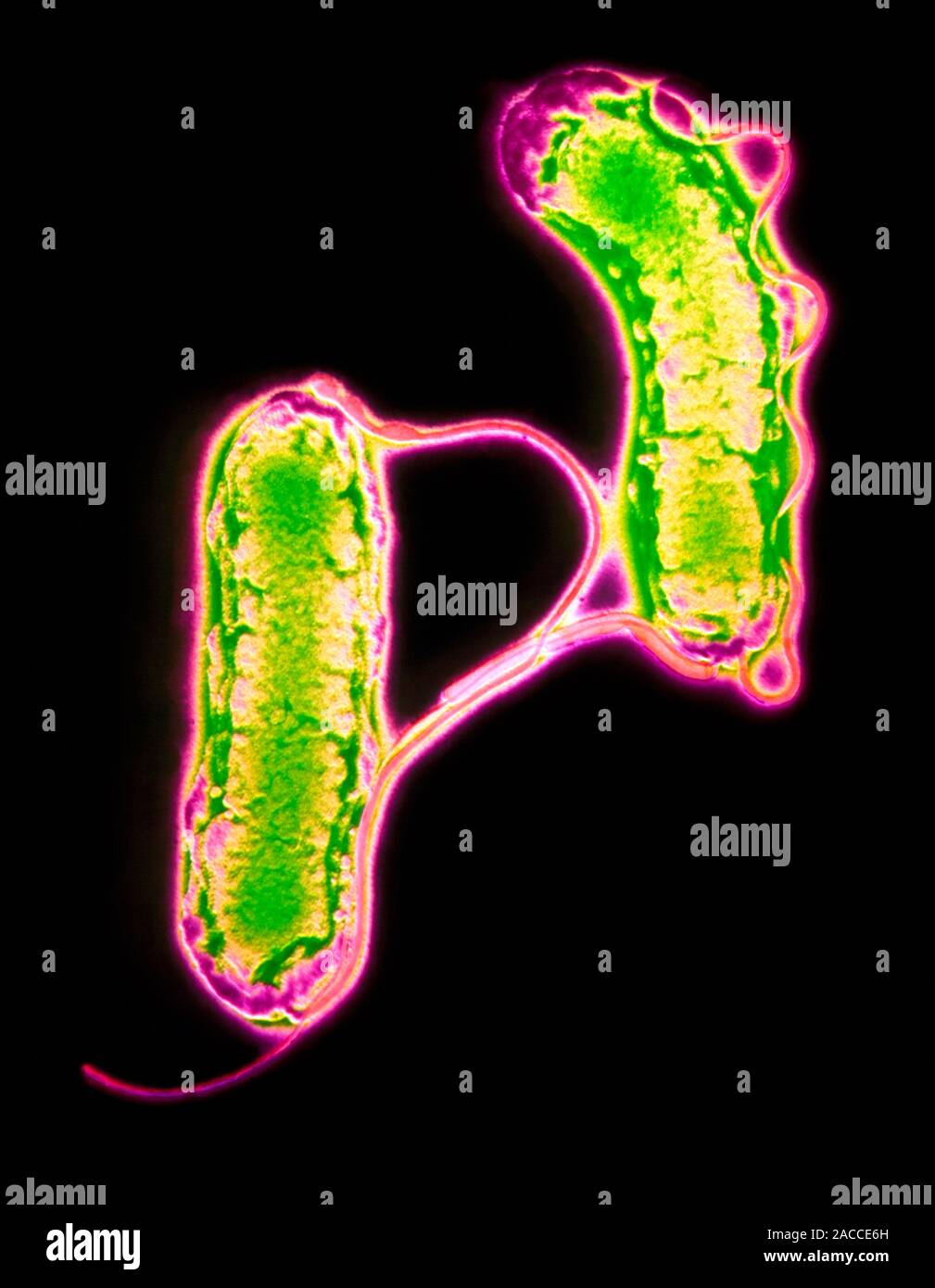 Helicobacter pylori. Coloured transmission electron micrograph of two