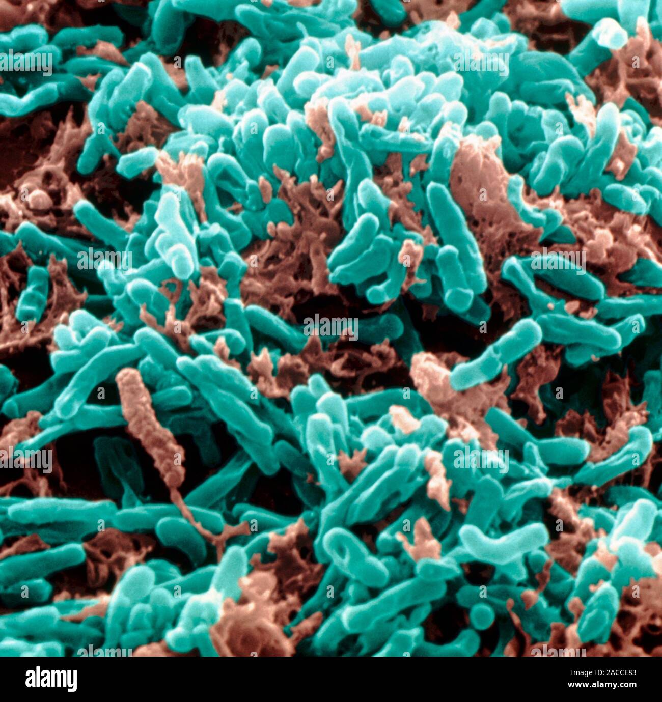 Новый вирус туберкулеза. Бактерия Mycobacterium tuberculosis. Палочка Коха Mycobacterium tuberculosis. Туберкулез палочка Коха под микроскопом.