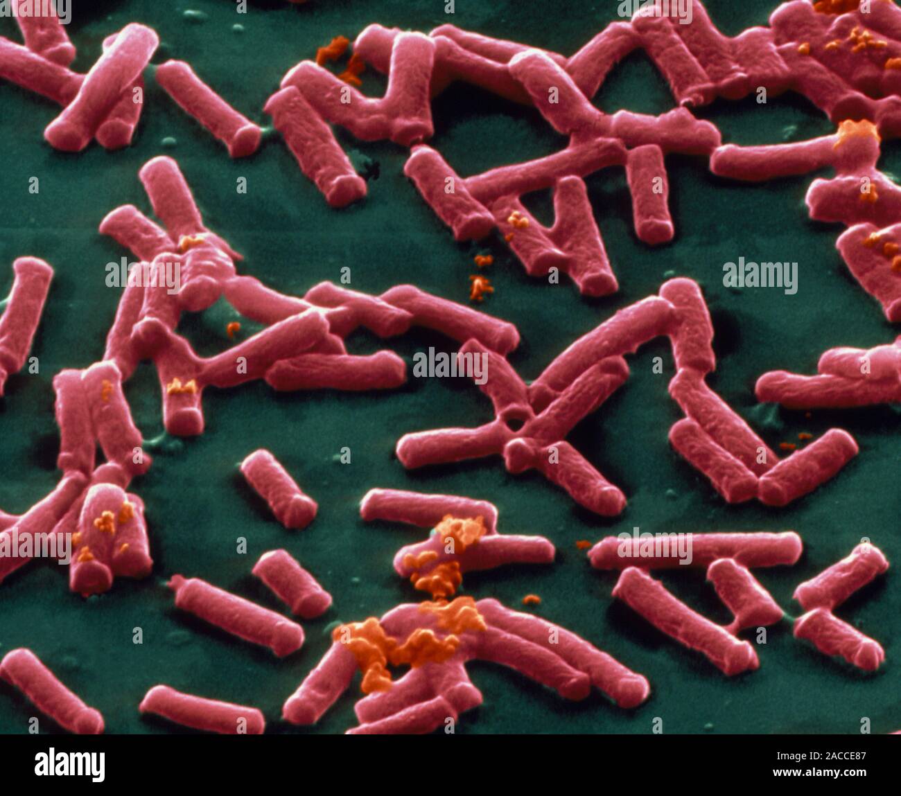 Clostridium perfringens. Coloured Scanning Electron Micrograph (SEM) of
