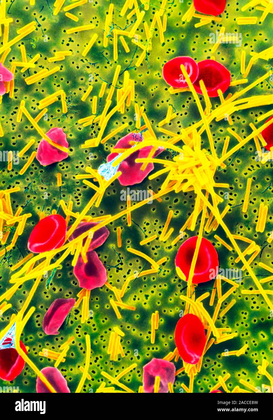 Eubacterium yurii. Scanning electron micrograph (SEM) of long rod