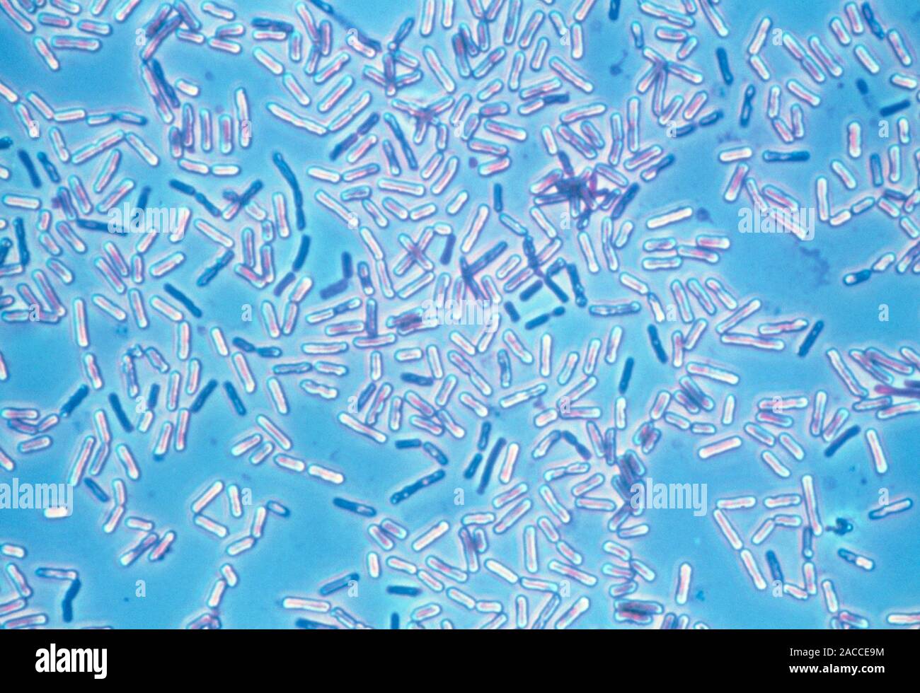 Rod Bacteria Diff Quick Bacteria. Light micrograph of unidentified rod- shaped bacterial cells ...