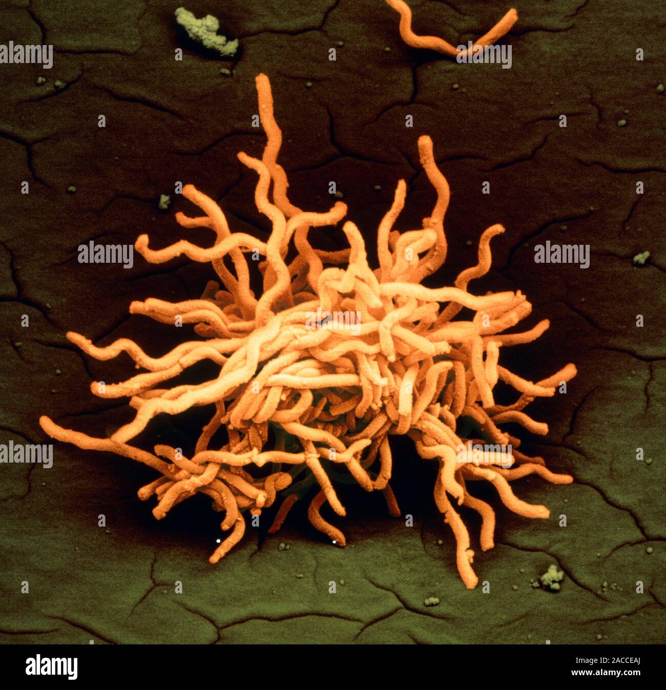 Lyme disease bacteria. Coloured scanning electron micrograph (SEM) of a ...