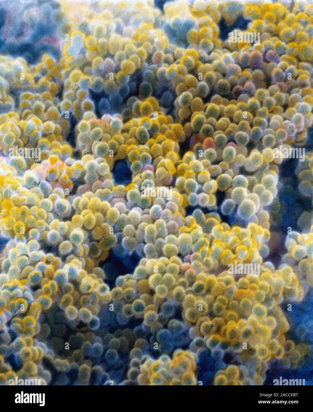 Moraxella (Branhamella) catarrhalis. Coloured scanning electron micrograph (SEM) of Moraxella