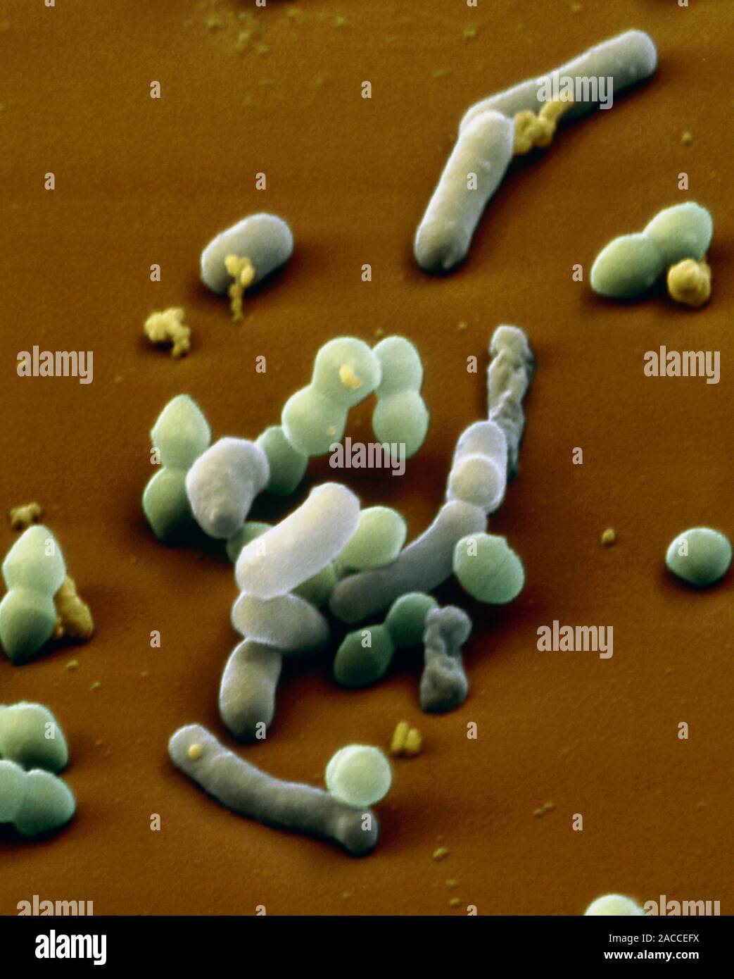 Кал на скрытую кровь референсные значения. Бактерии в кале что это значит. Анализ кишечной микрофлоры комплексный. Анализ кала на микроорганизмы. Микробиота кишечника.