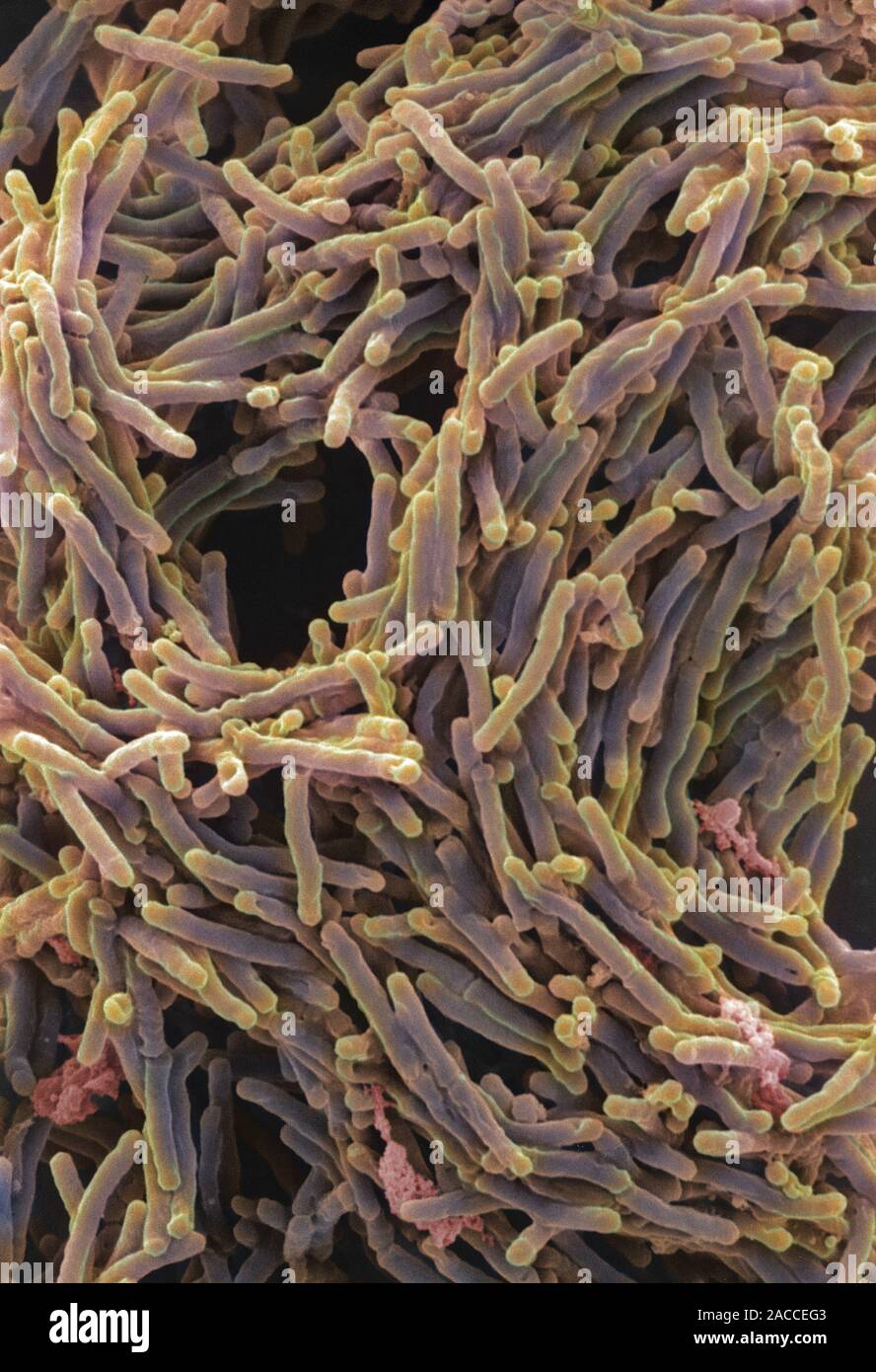 Tuberculosis bacteria. Coloured scanning electron micrograph (SEM) of ...