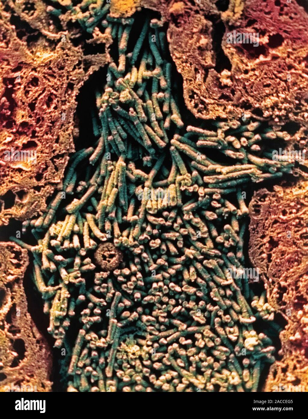 Anthrax Bacteria Coloured Scanning Electron Micrograph Sem Of A Section Through Lung Tissue 8568