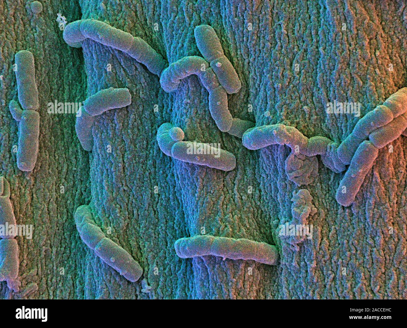 Bacillus cerus bacteria. Coloured scanning electron micrograph (SEM) of