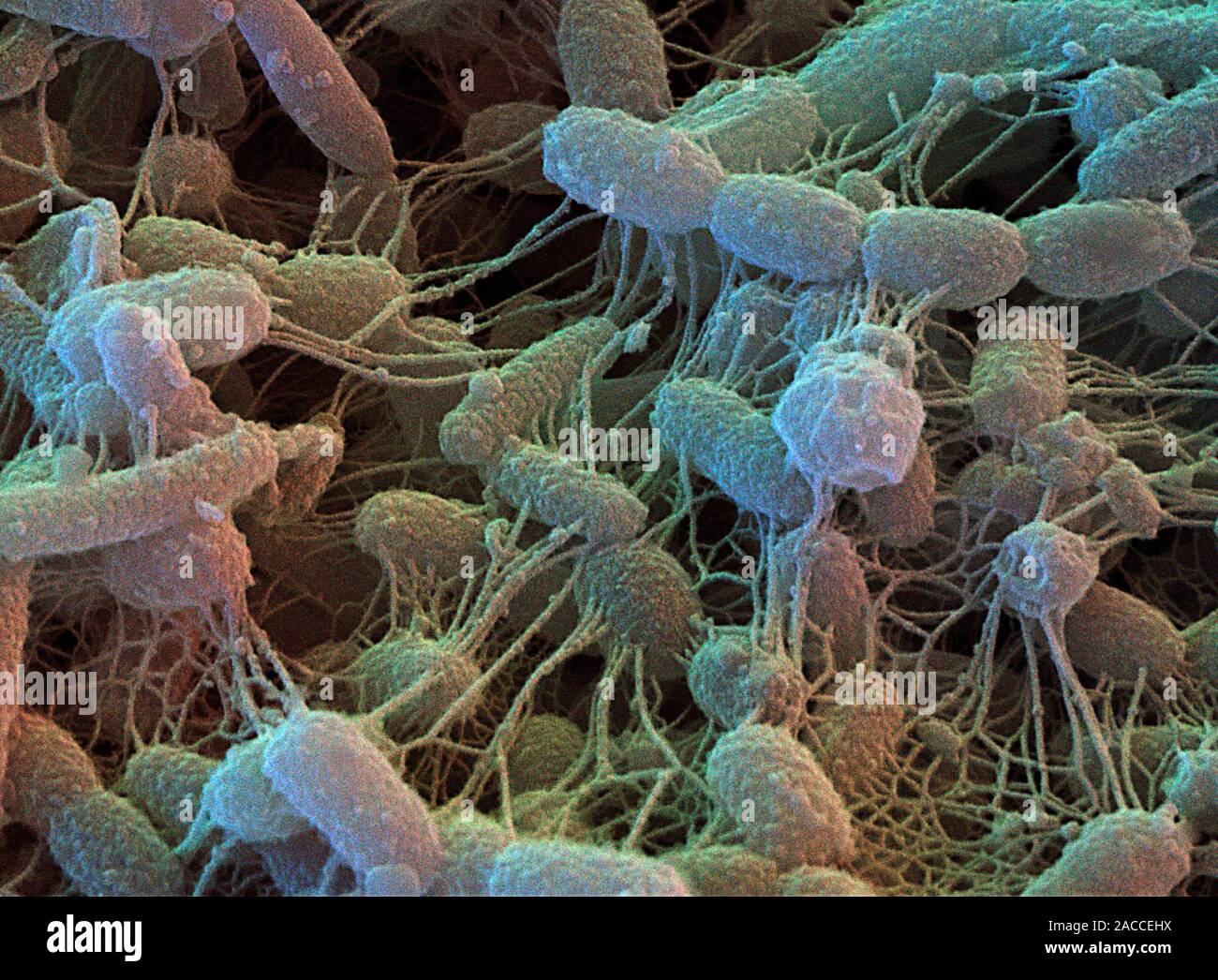 Инфекции в почве. Бактерии деструкторы. Сапрофиты бактерии гниения. Сапротрофные почвенные бактерии. Почвенные бактерии под микроскопом.