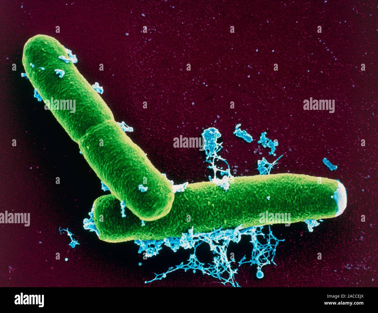 Бактерия вызывающая язву. Бацилла антрацис Сибирская язва. Bacillus anthracis Сибирская язва. Бактерия сибирской язвы под микроскопом.