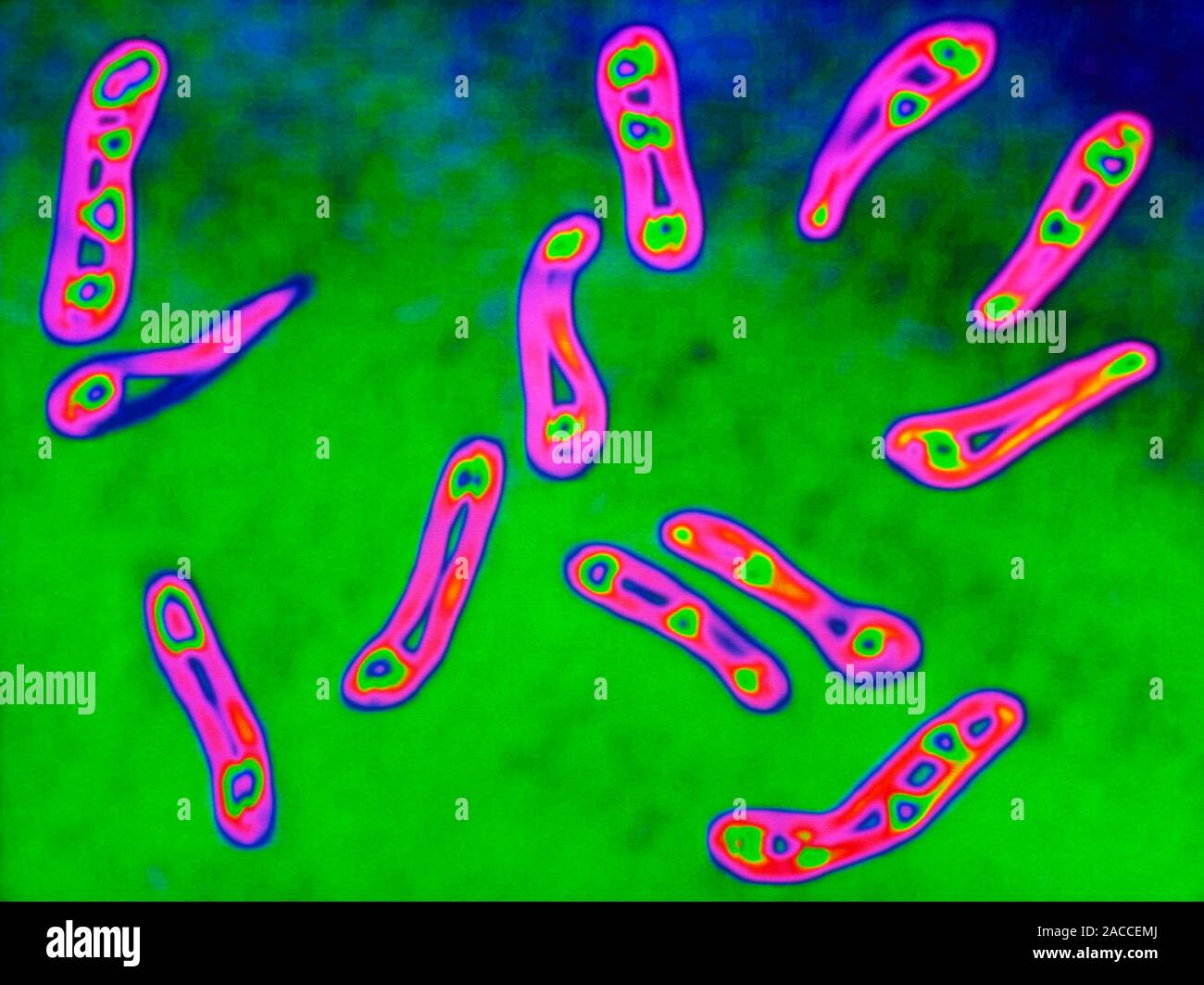 Дифтерийная палочка corynebacterium diphtheriae. Грамположительные палочки. Corynebacterium diphtheriae морфология. Коринобактерии дифтерии морфология. Морфология коринебактерий дифтерии.