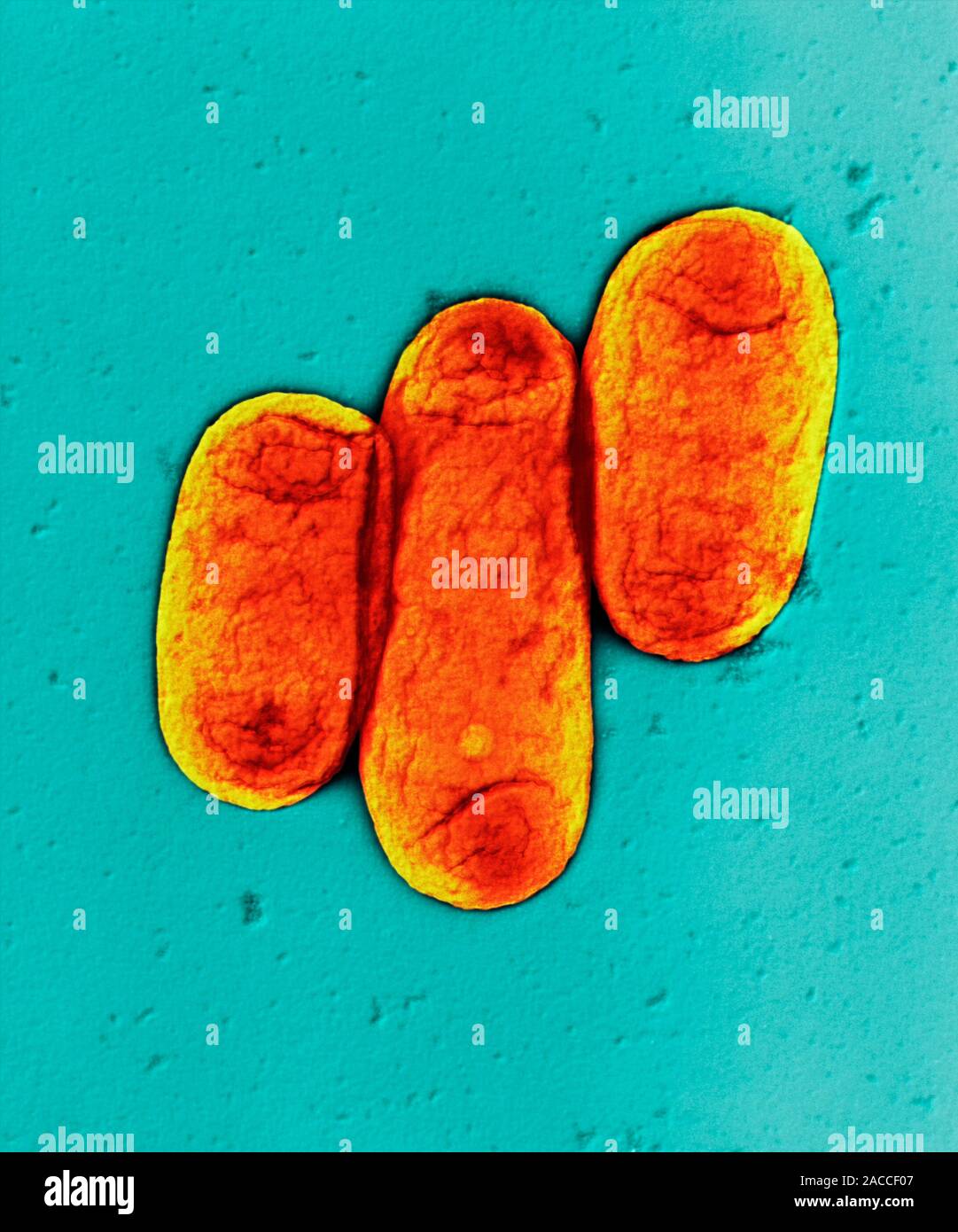 Plague bacteria (Yersinia pestis), coloured transmission electron
