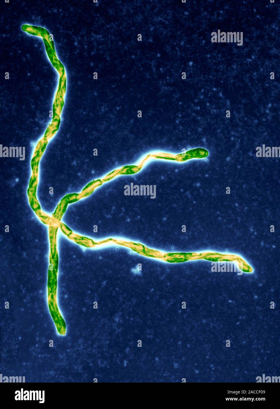 Snapshot of Borrelia Leukemia Transmission