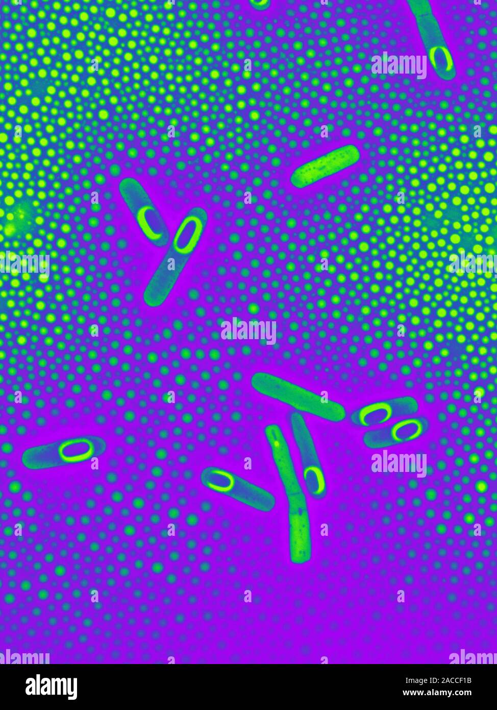 Clostridium difficile bacteria, coloured transmission electron ...