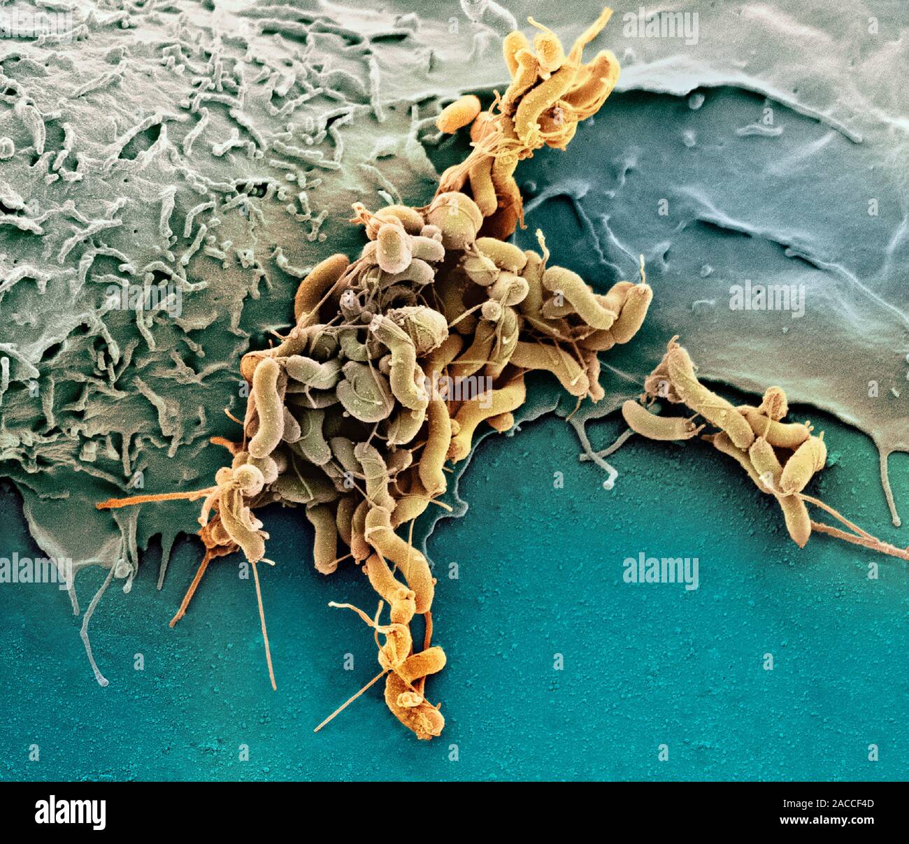 Причины появления бактерий в желудке. Бактерии хеликобактер пилори микроскопия. Бактерия хеликобактер пилори микроскоп. Хеликобактер пилори в микроскопе. Хеликобактер пилори под микроскопом.