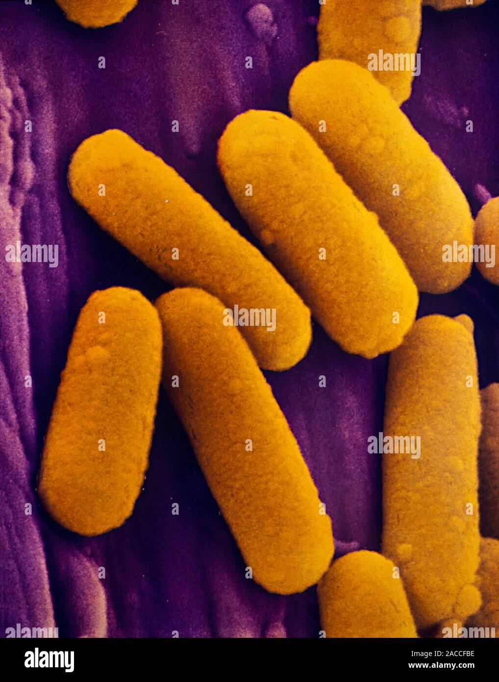 Coloured scanning electron micrograph (SEM) of bacteria (yellow) on the ...
