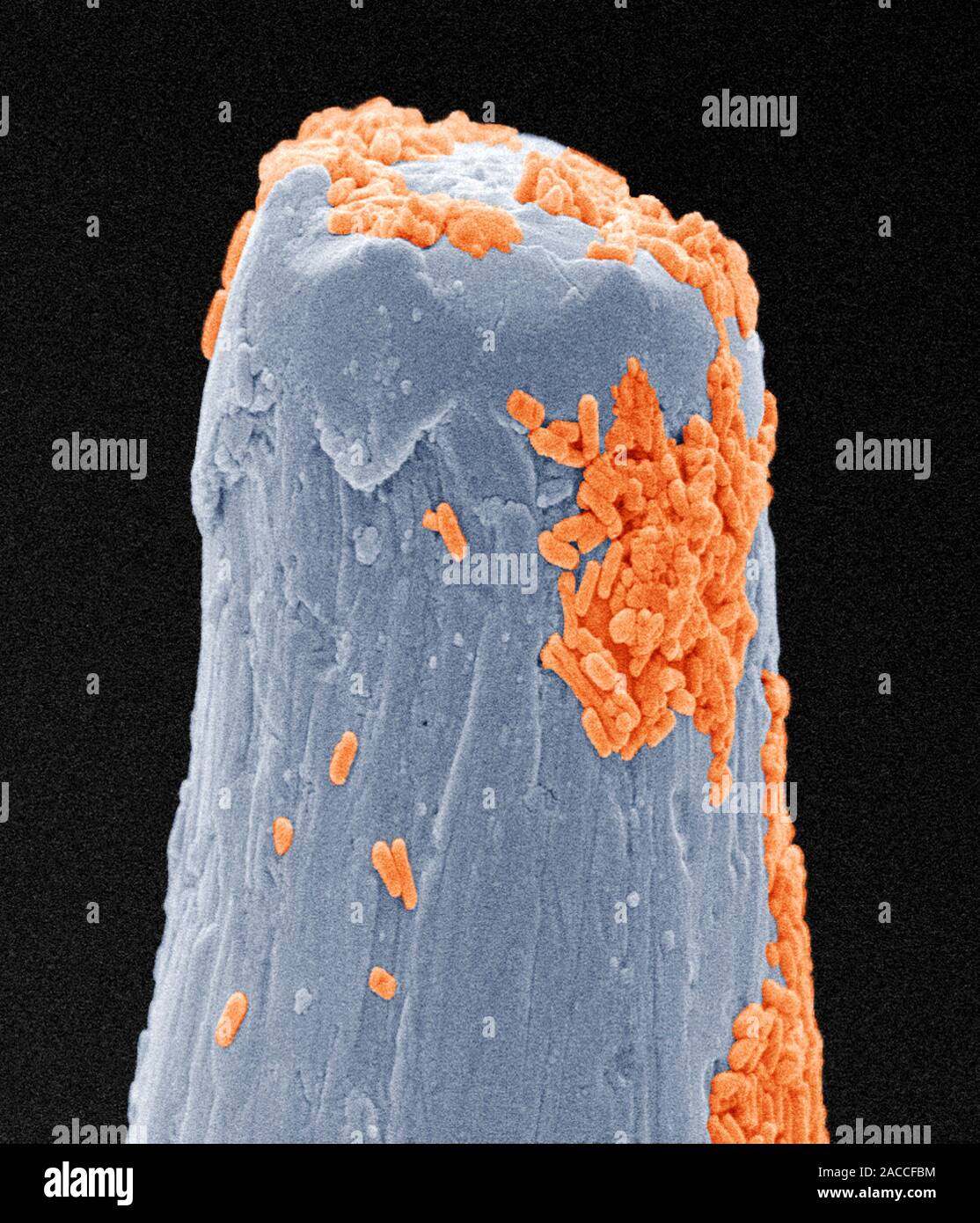 Bacteria on a pin. Coloured scanning electron micrograph (SEM) of ...