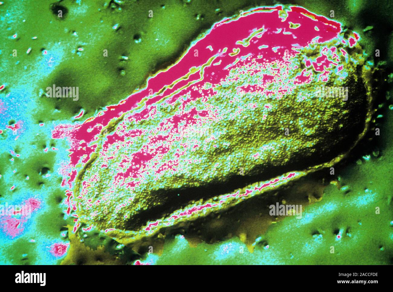 Escherichia coli. Coloured freezefracture Trans mission Electron