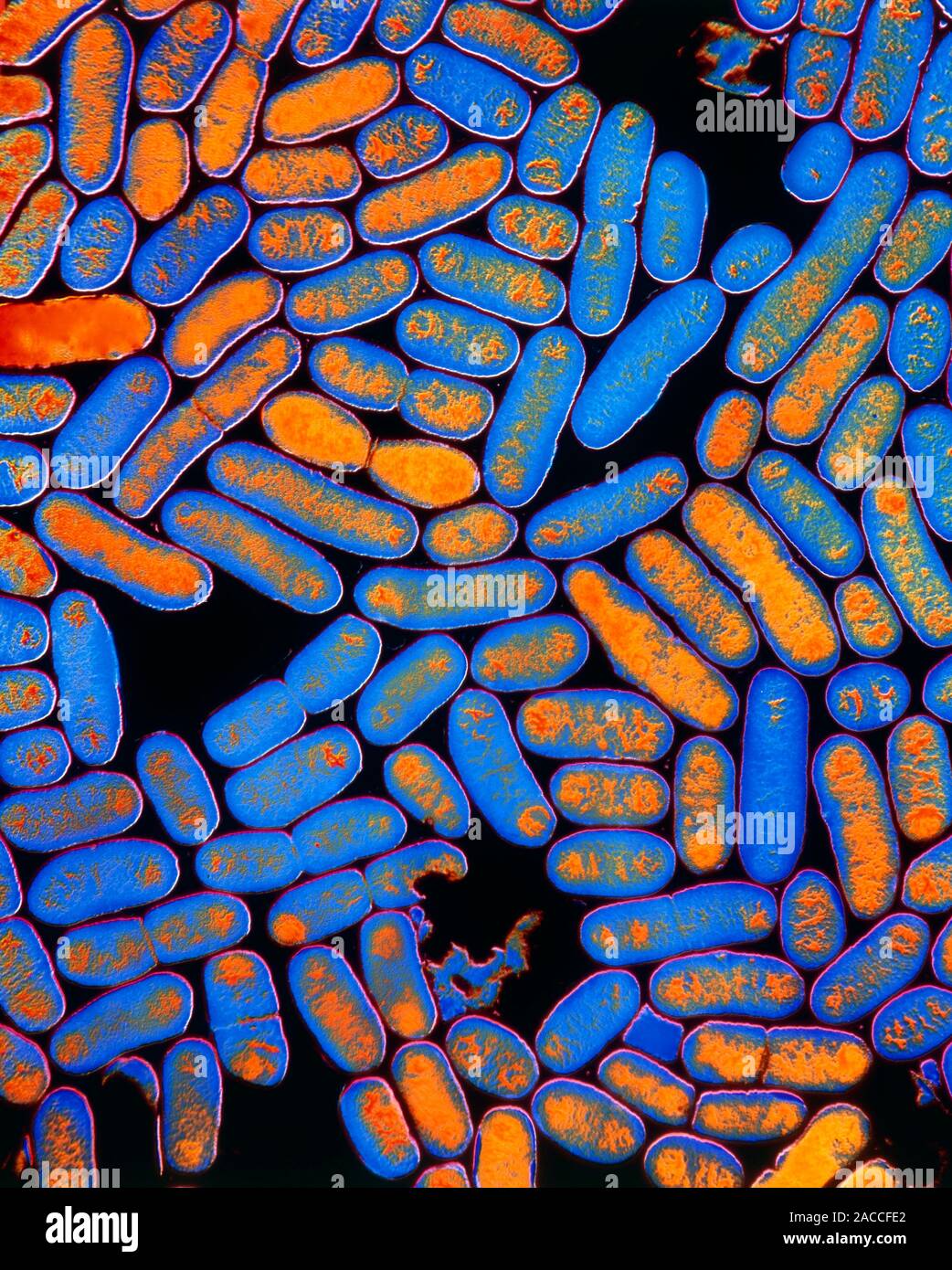 E. coli bacteria. Coloured transmission electron micrograph of a colony ...