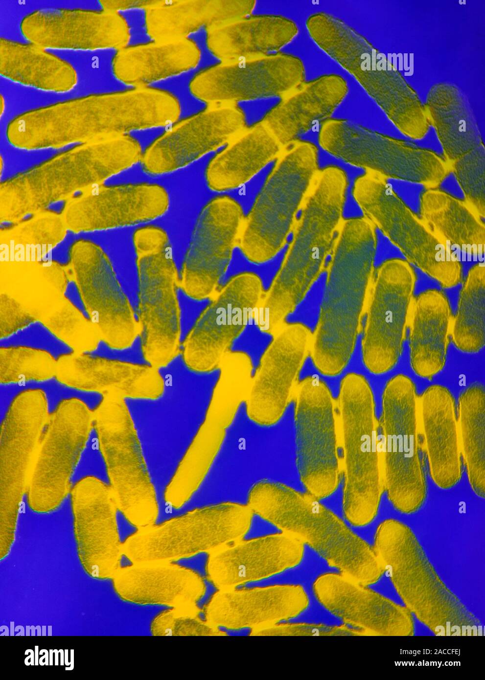 E. coli 0157H7 bacteria. Coloured transmission electron micrograph of