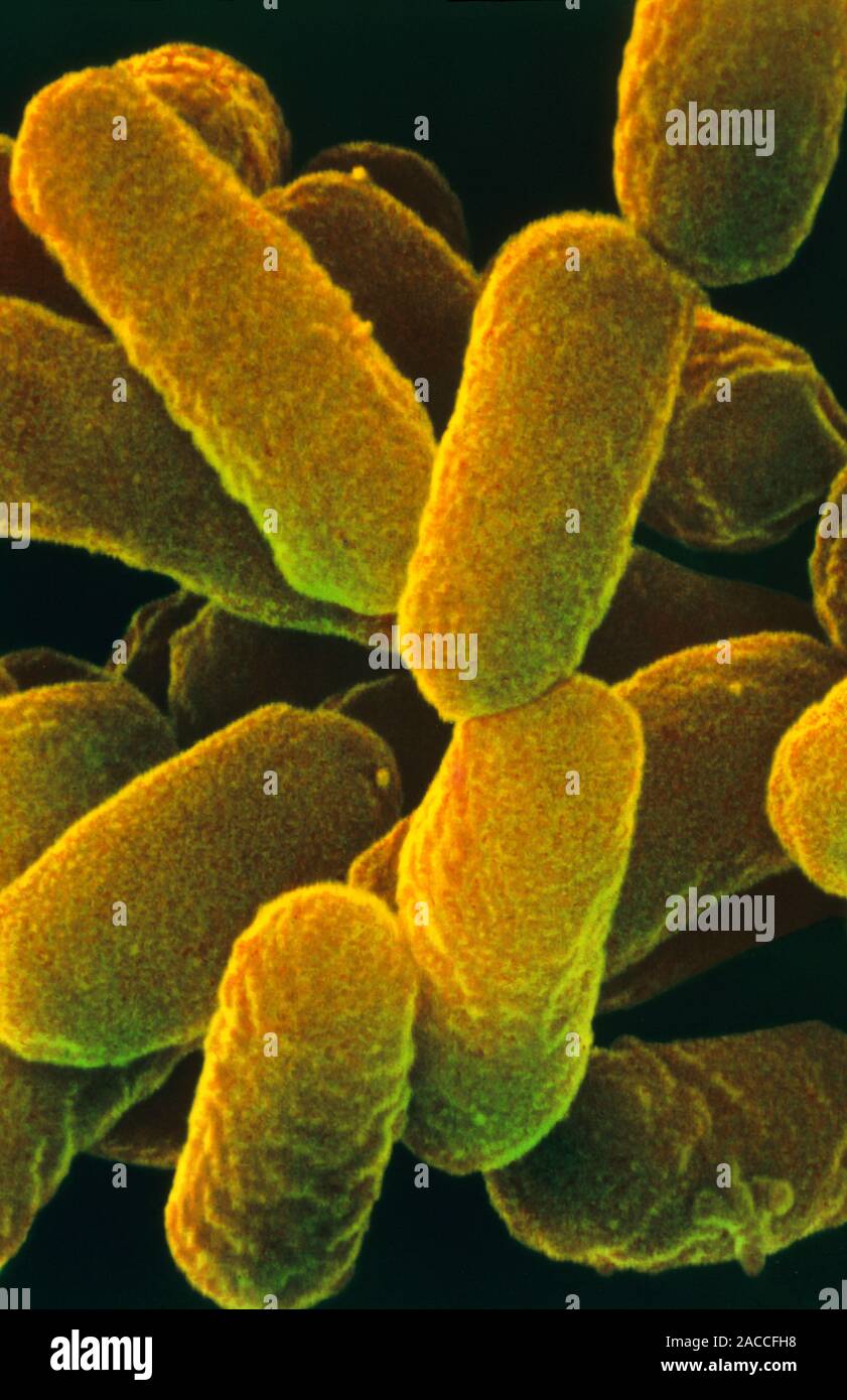 E. coli bacteria. Coloured scanning electron micrograph (SEM) of