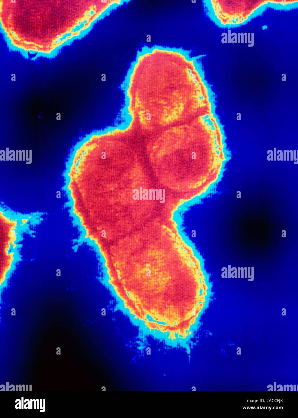 Escherichia coli bacteria. Coloured transmission electron micrograph