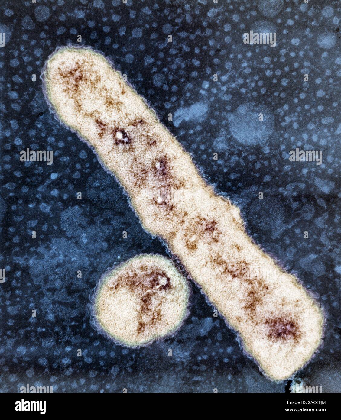 E. coli bacteria. Coloured transmission electron micrograph (TEM) of a