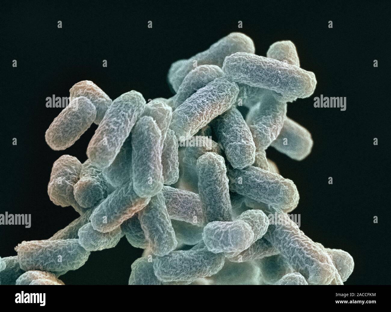 Микроорганизмы кишечная палочка