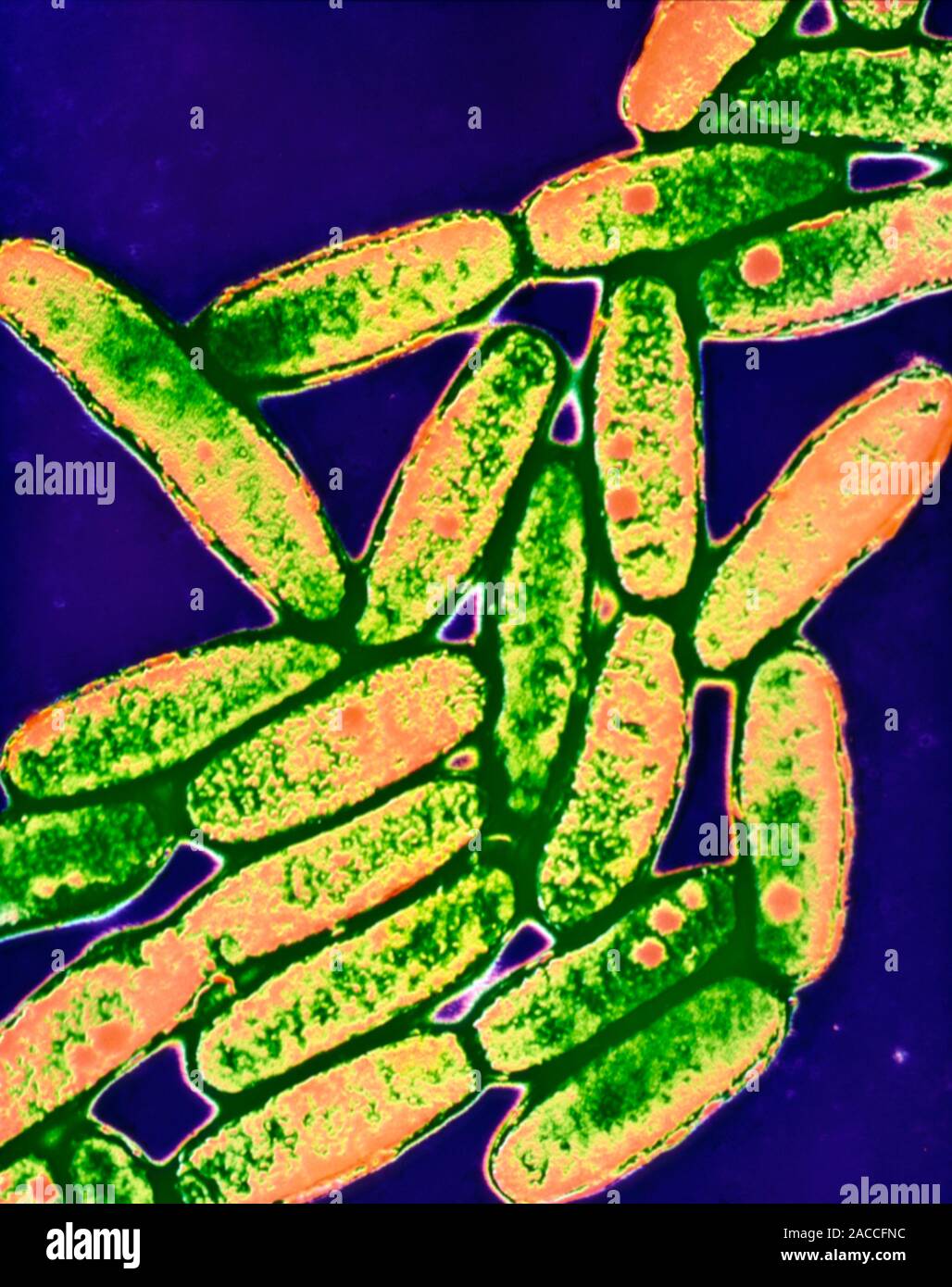 Legionella. Coloured transmission electron micrograph of the bacteria