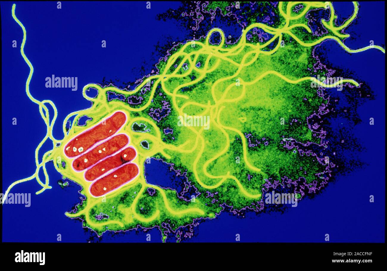 Legionella bacteria. Coloured transmission electron micrograph (TEM) of