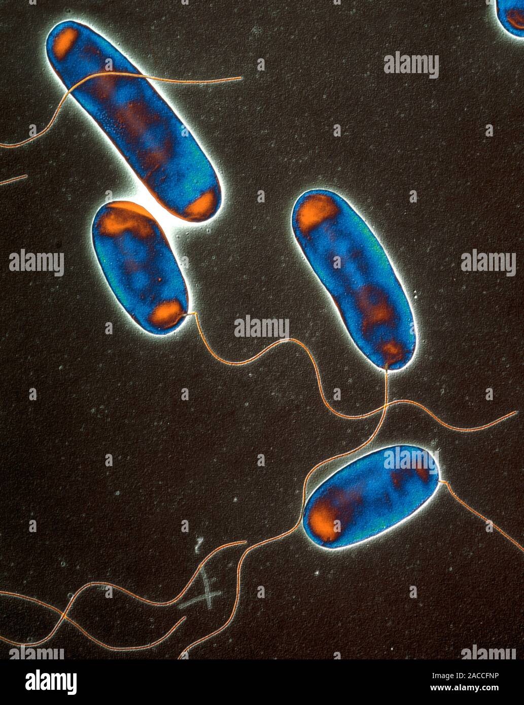 Legionella bacteria. Coloured transmission electron micrograph (TEM) of a section through