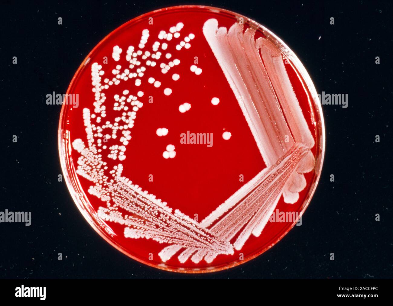 Photograph of a petri dish culture of the bacteria Staphylococcus